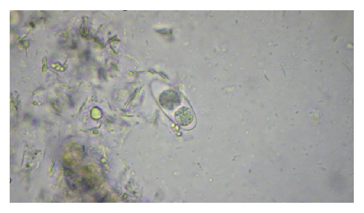 Intestinal Parasite Profile in the Stool of HIV Positive Patients in relation to Immune Status and Comparison of Various Diagnostic Techniques with Special Reference to Cryptosporidium at a Tertiary Care Hospital in South India.