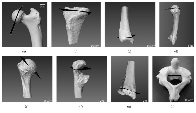 Limited Trabecular Bone Density Heterogeneity in the Human Skeleton.