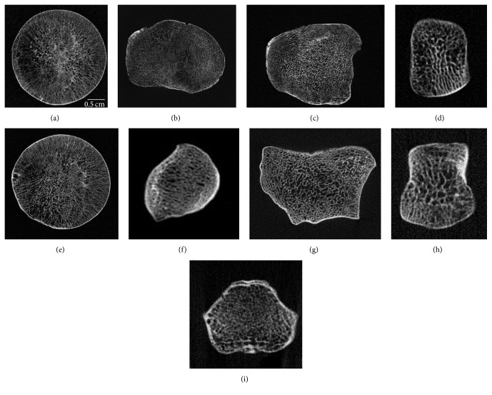Limited Trabecular Bone Density Heterogeneity in the Human Skeleton.