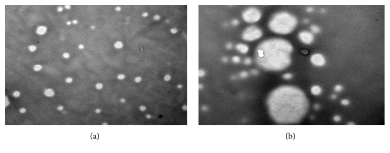 Design and Evaluation of Voriconazole Loaded Solid Lipid Nanoparticles for Ophthalmic Application.