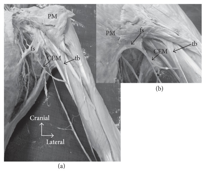 Bilateral Chondroepitrochlearis Muscle: Case Report, Phylogenetic Analysis, and Clinical Significance.