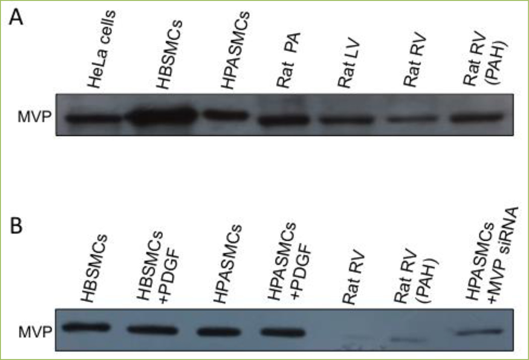 Major vault protein in cardiac and smooth muscle.