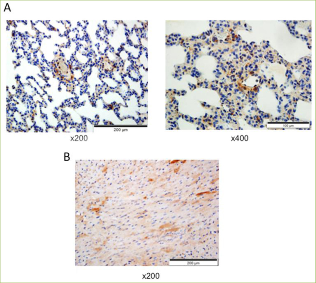 Major vault protein in cardiac and smooth muscle.