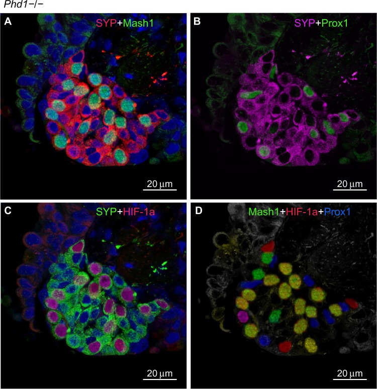 Hyperplasia and hypertrophy of pulmonary neuroepithelial bodies, presumed airway hypoxia sensors, in hypoxia-inducible factor prolyl hydroxylase-deficient mice.