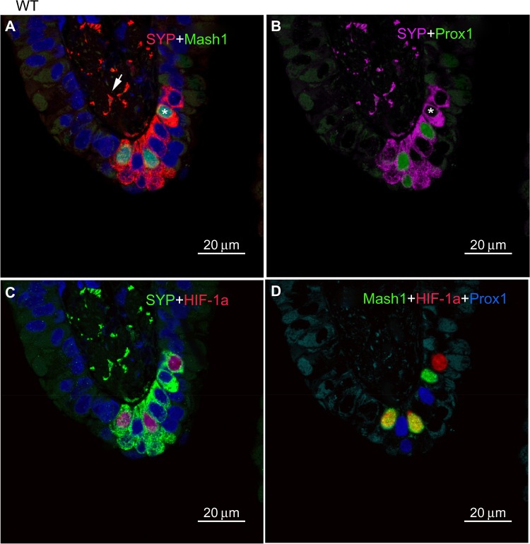 Hyperplasia and hypertrophy of pulmonary neuroepithelial bodies, presumed airway hypoxia sensors, in hypoxia-inducible factor prolyl hydroxylase-deficient mice.