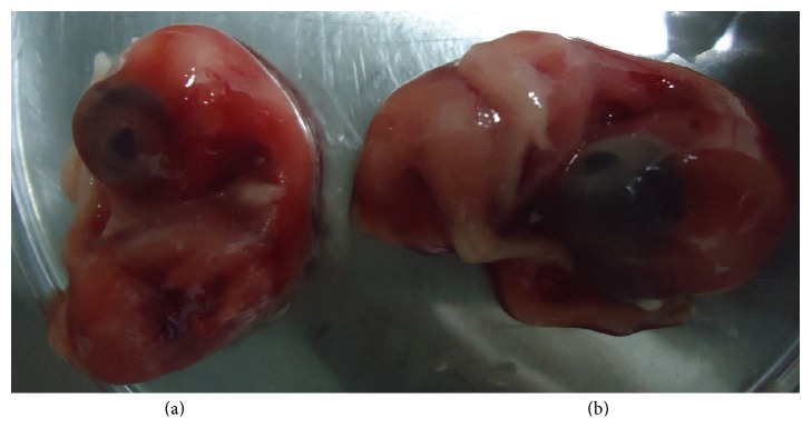 Isolation and Metagenomic Identification of Avian Leukosis Virus Associated with Mortality in Broiler Chicken.