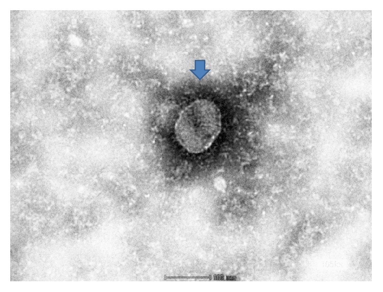 Isolation and Metagenomic Identification of Avian Leukosis Virus Associated with Mortality in Broiler Chicken.