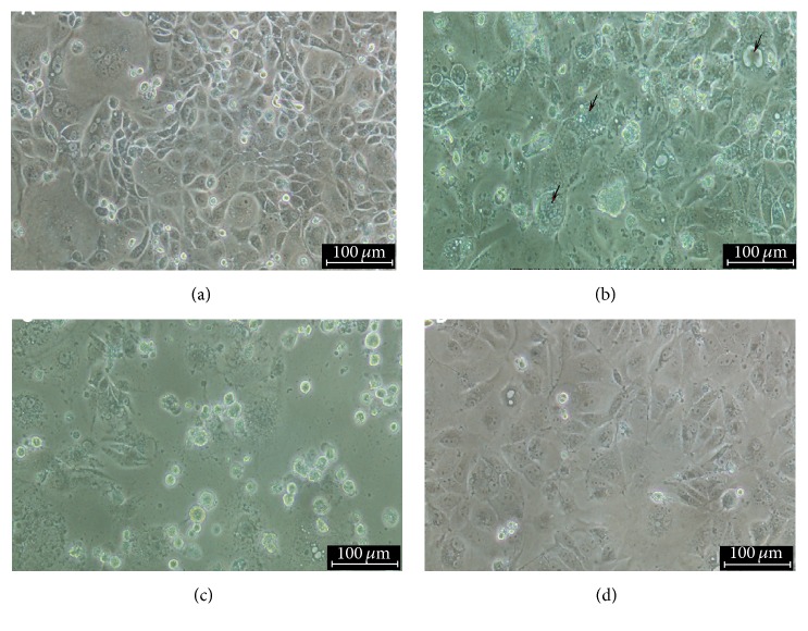 Isolation and Metagenomic Identification of Avian Leukosis Virus Associated with Mortality in Broiler Chicken.