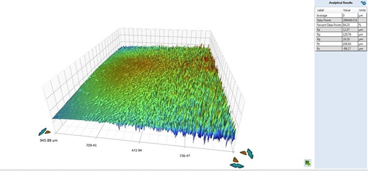 Effect of surface treatment on enamel surface roughness.