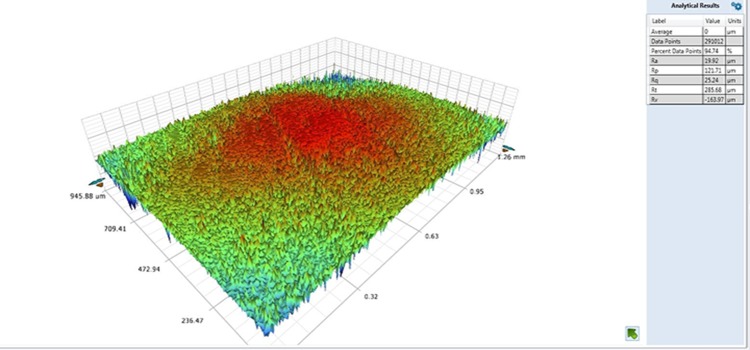 Effect of surface treatment on enamel surface roughness.