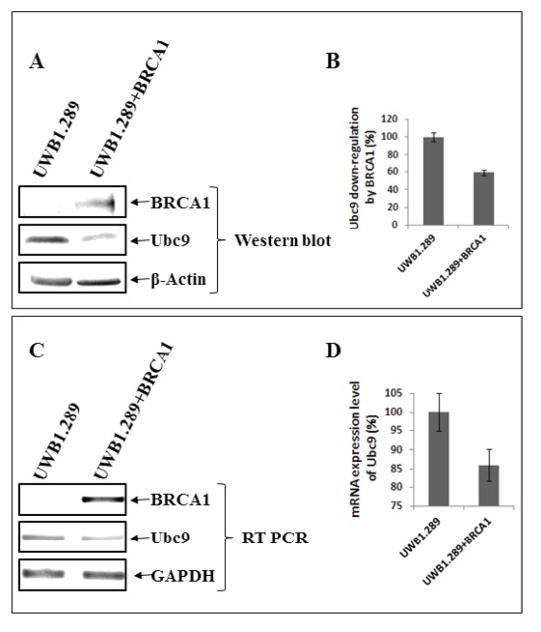 BRCA1 Mutation Leads to Deregulated Ubc9 Levels which Triggers Proliferation and Migration of Patient-Derived High Grade Serous Ovarian Cancer and Triple Negative Breast Cancer Cells.