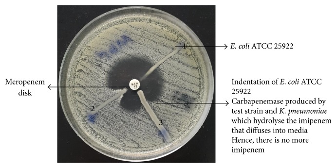 Phenotypic Detection of Metallo-Beta-Lactamases in Carbapenem Resistant Acinetobacter baumannii Isolated from Pediatric Patients in Pakistan.