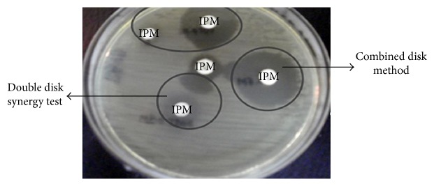 Phenotypic Detection of Metallo-Beta-Lactamases in Carbapenem Resistant Acinetobacter baumannii Isolated from Pediatric Patients in Pakistan.