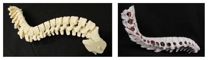 Possibilities of Preoperative Medical Models Made by 3D Printing or Additive Manufacturing.