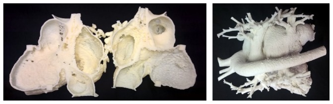 Possibilities of Preoperative Medical Models Made by 3D Printing or Additive Manufacturing.