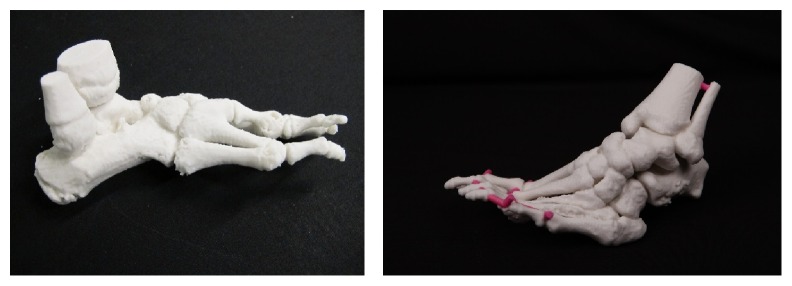 Possibilities of Preoperative Medical Models Made by 3D Printing or Additive Manufacturing.