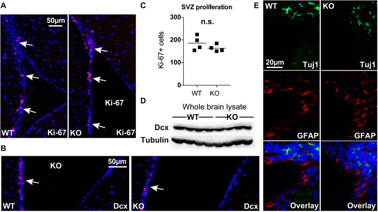 αT-catenin in restricted brain cell types and its potential connection to autism.