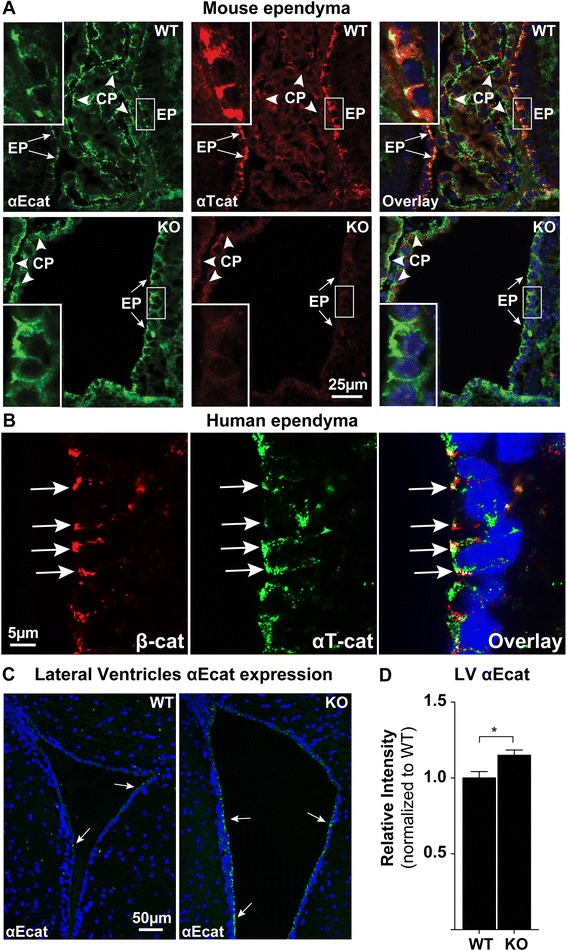 αT-catenin in restricted brain cell types and its potential connection to autism.