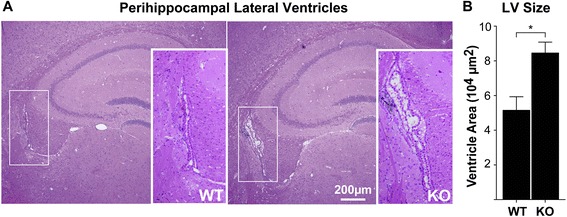 αT-catenin in restricted brain cell types and its potential connection to autism.