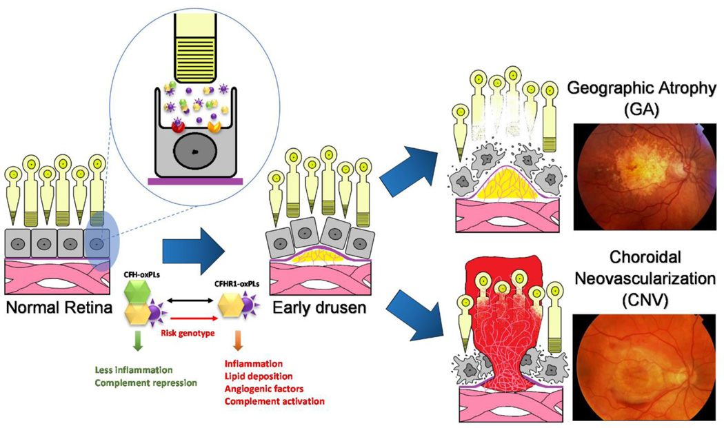 Oxidative stress, innate immunity, and age-related macular degeneration.