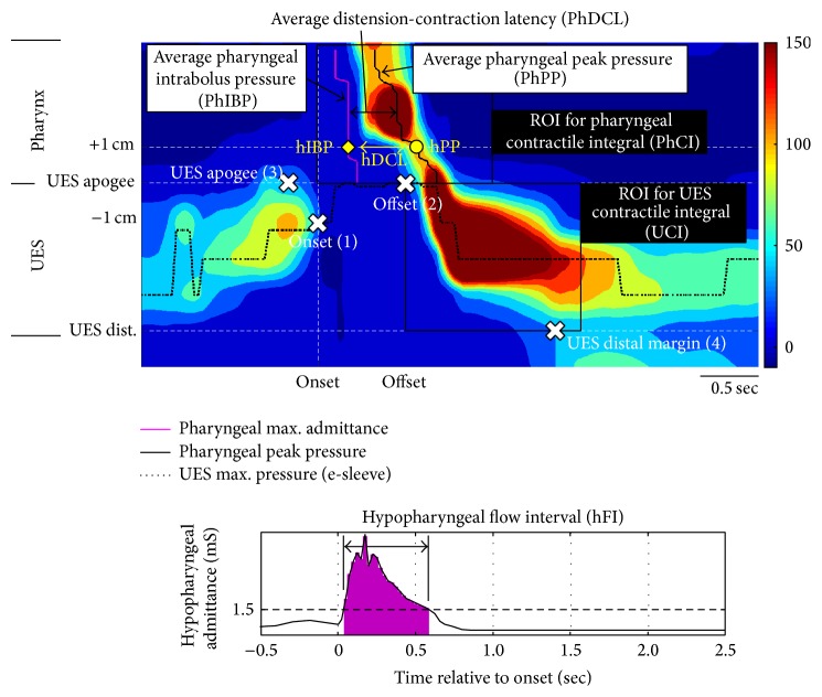 The Reliability of Pharyngeal High Resolution Manometry with Impedance for Derivation of Measures of Swallowing Function in Healthy Volunteers.