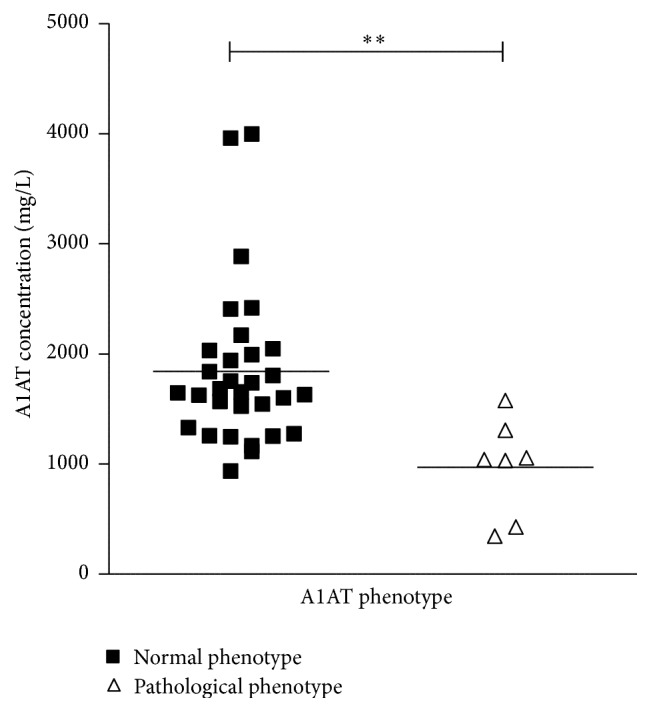 The Diagnostic Value of Alpha-1-Antitrypsin Phenotype in Patients with Granulomatosis with Polyangiitis.