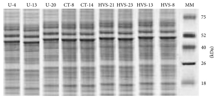 Total Protein Profile and Drug Resistance in Candida albicans Isolated from Clinical Samples.