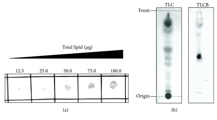 High-Density Lipoprotein Binds to Mycobacterium avium and Affects the Infection of THP-1 Macrophages.