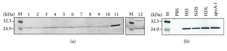 High-Density Lipoprotein Binds to Mycobacterium avium and Affects the Infection of THP-1 Macrophages.