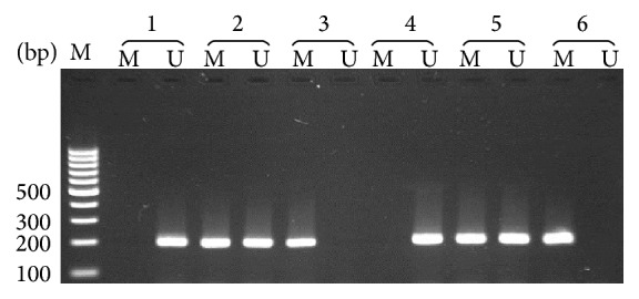 Promoter Methylation and mRNA Expression of Response Gene to Complement 32 in Breast Carcinoma.