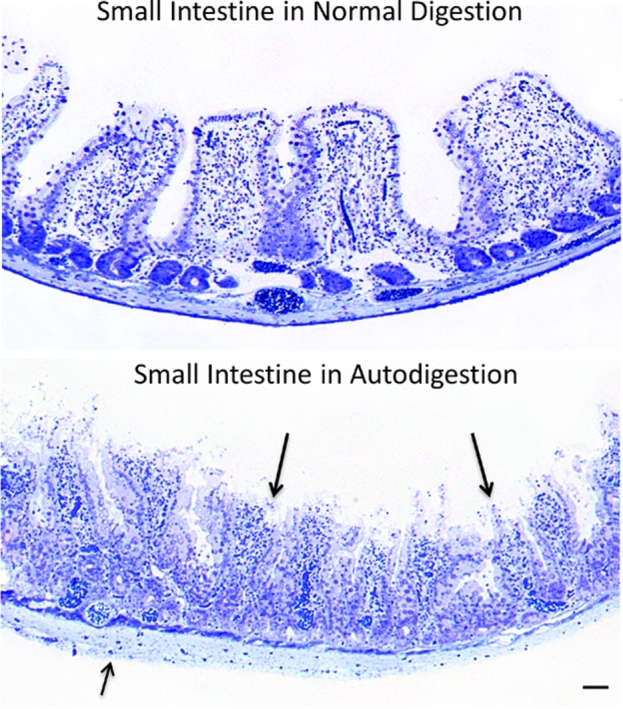 The autodigestion hypothesis: Proteolytic receptor cleavage in rheological and cardiovascular cell dysfunction1.