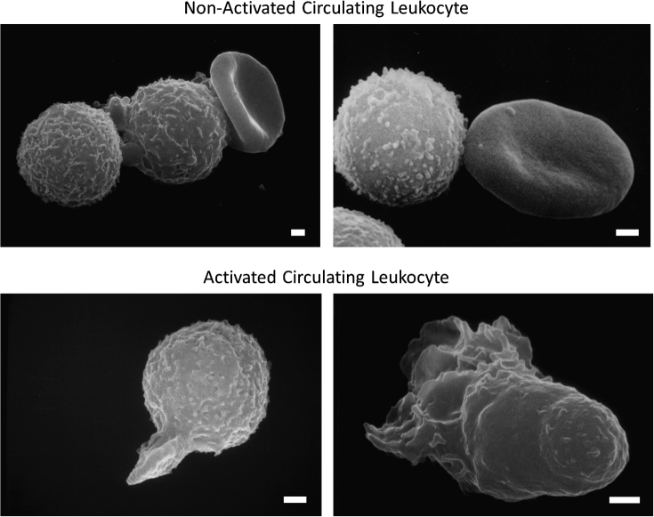 The autodigestion hypothesis: Proteolytic receptor cleavage in rheological and cardiovascular cell dysfunction1.