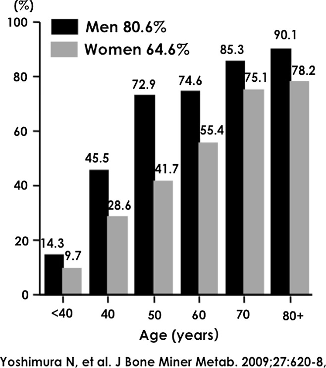 Epidemiology of Locomotive Organ Disorders and Symptoms: An Estimation Using the Population-Based Cohorts in Japan.