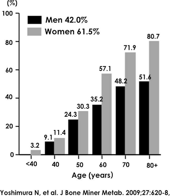 Epidemiology of Locomotive Organ Disorders and Symptoms: An Estimation Using the Population-Based Cohorts in Japan.