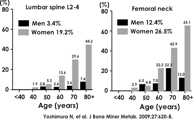 Epidemiology of Locomotive Organ Disorders and Symptoms: An Estimation Using the Population-Based Cohorts in Japan.