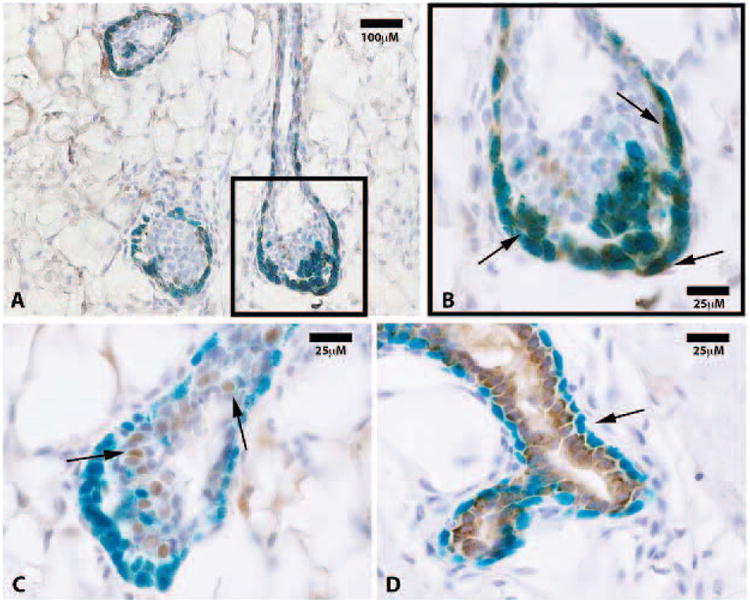 Mammary Epithelial Cell Lineage Analysis via the Lyon's Hypothesis.