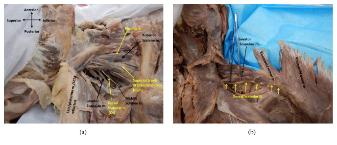 A Cadaveric Investigation of the Dorsal Scapular Nerve.