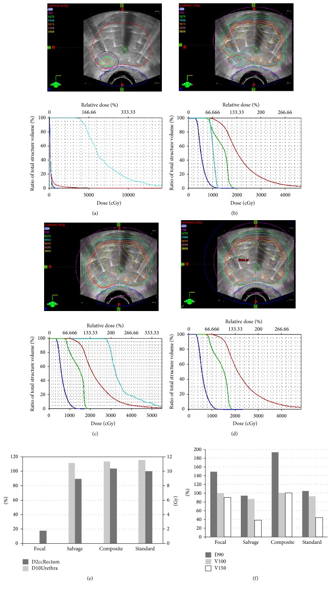 Systematic Review of Focal Prostate Brachytherapy and the Future Implementation of Image-Guided Prostate HDR Brachytherapy Using MR-Ultrasound Fusion.