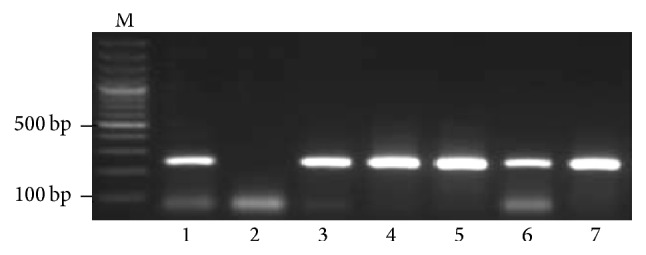 PCR-Based Molecular Diagnosis of Hepatitis Virus (HBV and HDV) in HCV Infected Patients and Their Biochemical Study.