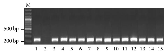 PCR-Based Molecular Diagnosis of Hepatitis Virus (HBV and HDV) in HCV Infected Patients and Their Biochemical Study.