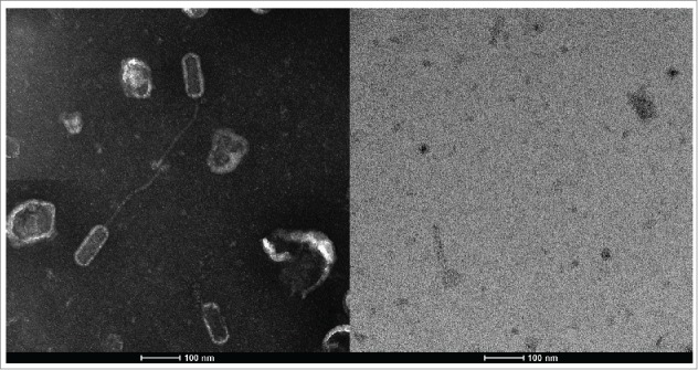 Experimental bacteriophage treatment of honeybees (<i>Apis mellifera</i>) infected with <i>Paenibacillus larvae</i>, the causative agent of American Foulbrood Disease.