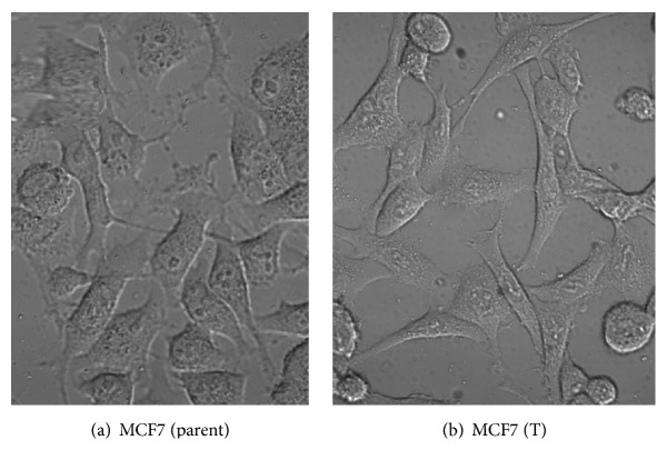 Drug Efflux Transporters Are Overexpressed in Short-Term Tamoxifen-Induced MCF7 Breast Cancer Cells.