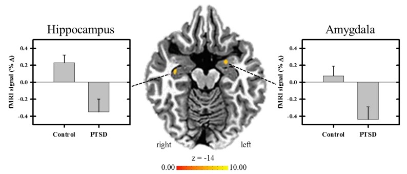 Exploring the Neurocircuitry Underpinning Predictability of Threat in Soldiers with PTSD Compared to Deployment Exposed Controls.