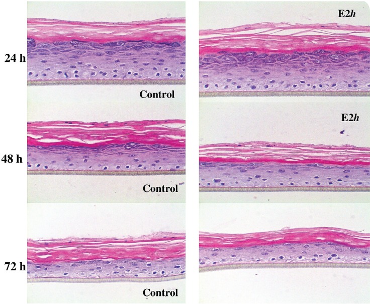 Study of the cytotoxic/toxic potential of the novel anticancer selenodiazoloquinolone on fibroblast cells and 3D skin model.