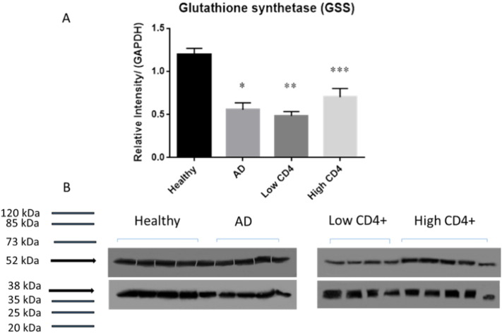 Analysis of glutathione levels in the brain tissue samples from HIV-1-positive individuals and subject with Alzheimer's disease and its implication in the pathophysiology of the disease process