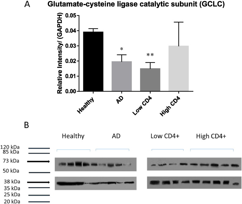 Analysis of glutathione levels in the brain tissue samples from HIV-1-positive individuals and subject with Alzheimer's disease and its implication in the pathophysiology of the disease process