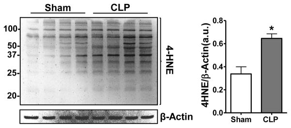 Renal Mitochondrial Lipid Peroxidation during Sepsis.