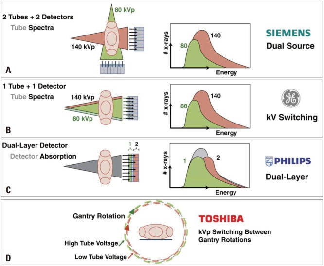 Multimodality Imaging in Coronary Artery Disease: Focus on Computed Tomography.