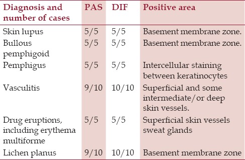 Periodic Acid-Schiff Staining Parallels the Immunoreactivity Seen By Direct Immunofluorescence in Autoimmune Skin Diseases.