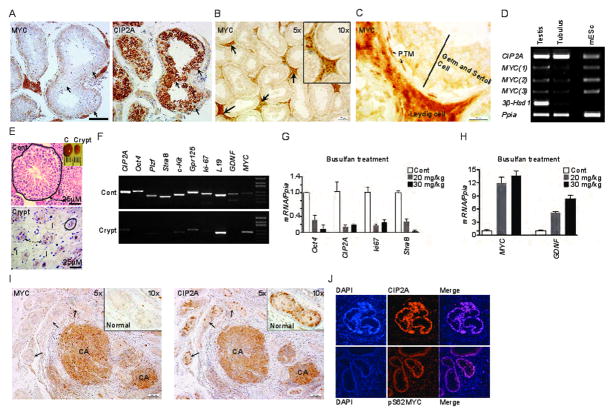 MYC is not detected in highly proliferating normal spermatogonia but is coupled with CIP2A in testicular cancers.